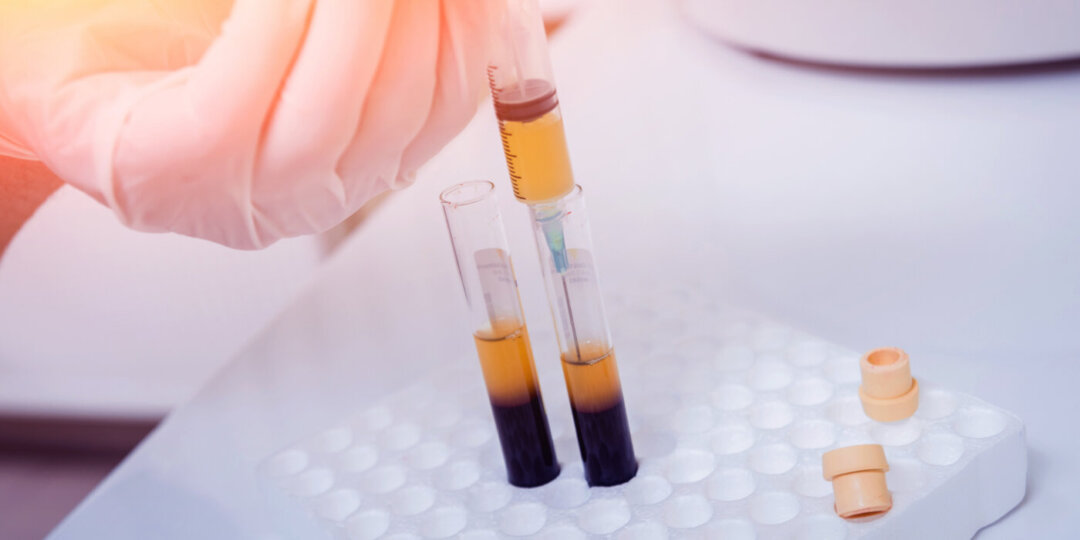 27 Highest Paying Plasma Donation Centers Near Me [1000/Mon]